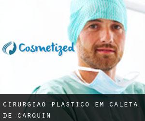 Cirurgião Plástico em Caleta de Carquín