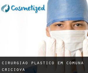 Cirurgião Plástico em Comuna Criciova