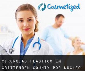 Cirurgião plástico em Crittenden County por núcleo urbano - página 1