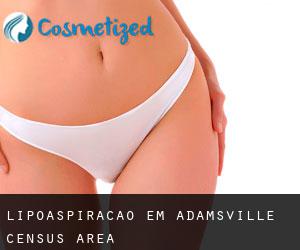 Lipoaspiração em Adamsville (census area)