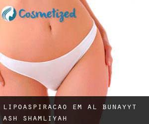 Lipoaspiração em Al Bunayyāt ash Shamālīyah