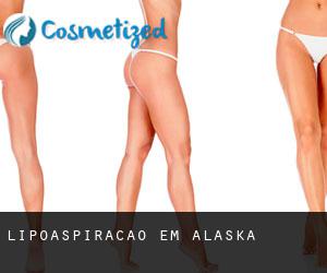 Lipoaspiração em Alaska Lipoaspiração em Alaska