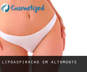 Lipoaspiração em Altomonte