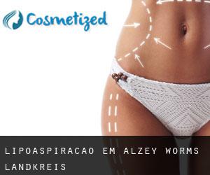 Lipoaspiração em Alzey-Worms Landkreis Lipoaspiração em Alzey-Worms Landkreis
