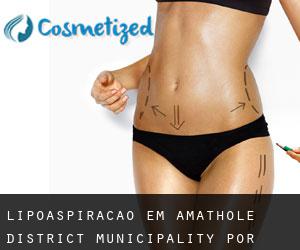 Lipoaspiração em Amathole District Municipality por núcleo urbano - página 1
