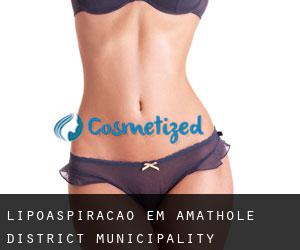 Lipoaspiração em Amathole District Municipality