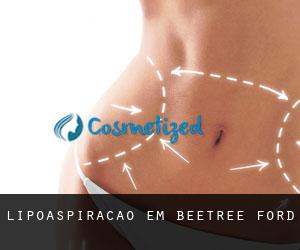 Lipoaspiração em Beetree Ford