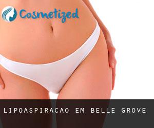 Lipoaspiração em Belle Grove