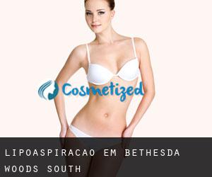 Lipoaspiração em Bethesda Woods South