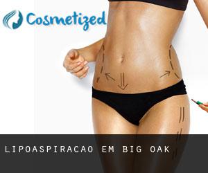 Lipoaspiração em Big Oak