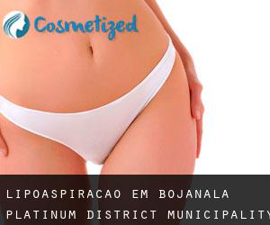 Lipoaspiração em Bojanala Platinum District Municipality