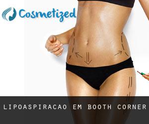 Lipoaspiração em Booth Corner