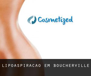 Lipoaspiração em Boucherville