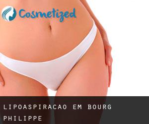 Lipoaspiração em Bourg-Philippe