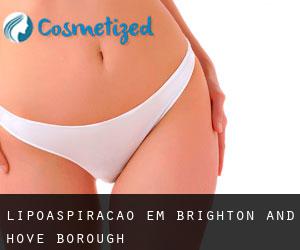 Lipoaspiração em Brighton and Hove (Borough)
