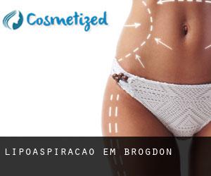 Lipoaspiração em Brogdon