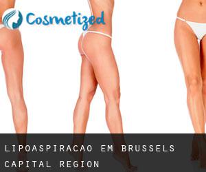 Lipoaspiração em Brussels Capital Region