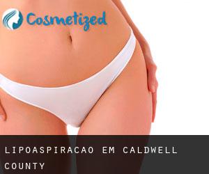 Lipoaspiração em Caldwell County