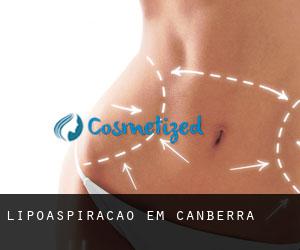 Lipoaspiração em Canberra