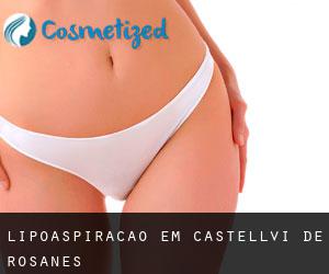 Lipoaspiração em Castellví de Rosanes