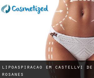 Lipoaspiração em Castellví de Rosanes