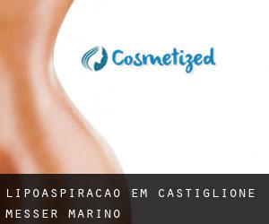 Lipoaspiração em Castiglione Messer Marino