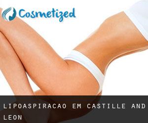 Lipoaspiração em Castille and León Lipoaspiração em Castille and León