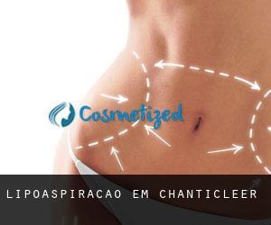 Lipoaspiração em Chanticleer