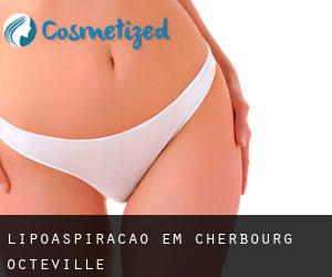Lipoaspiração em Cherbourg-Octeville