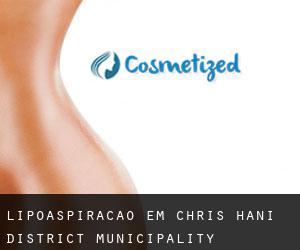 Lipoaspiração em Chris Hani District Municipality
