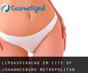 Lipoaspiração em City of Johannesburg Metropolitan Municipality