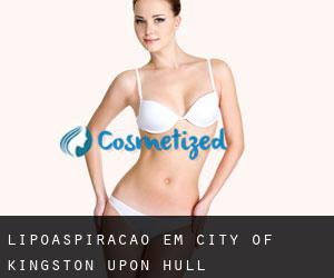 Lipoaspiração em City of Kingston upon Hull
