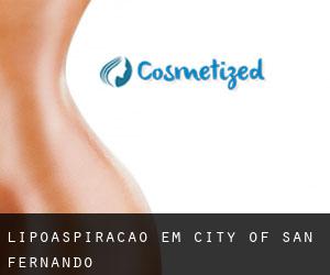 Lipoaspiração em City of San Fernando