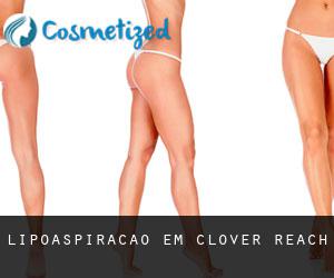 Lipoaspiração em Clover Reach