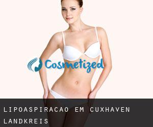 Lipoaspiração em Cuxhaven Landkreis