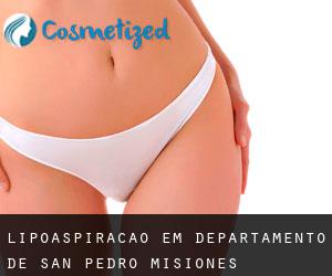 Lipoaspiração em Departamento de San Pedro (Misiones)
