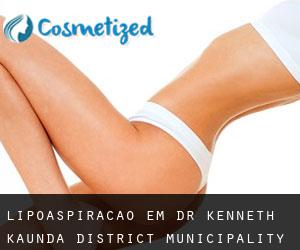 Lipoaspiração em Dr Kenneth Kaunda District Municipality