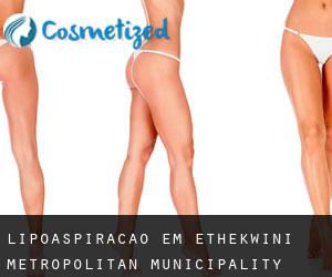 Lipoaspiração em eThekwini Metropolitan Municipality