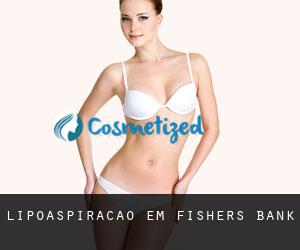 Lipoaspiração em Fishers Bank