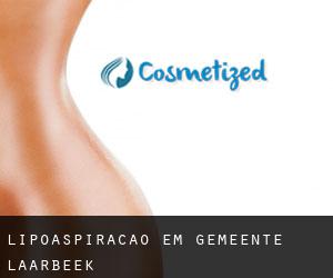 Lipoaspiração em Gemeente Laarbeek