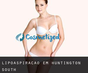 Lipoaspiração em Huntington South