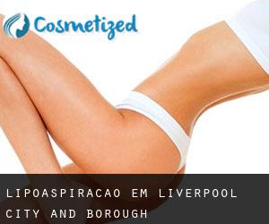 Lipoaspiração em Liverpool (City and Borough)