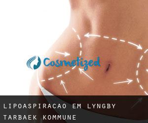 Lipoaspiração em Lyngby-Tårbæk Kommune