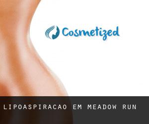 Lipoaspiração em Meadow Run