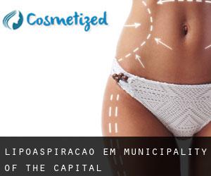 Lipoaspiração em Municipality of the Capital