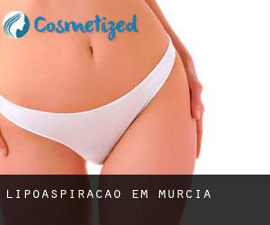 Lipoaspiração em Murcia Lipoaspiração em Murcia
