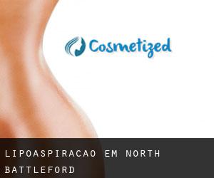 Lipoaspiração em North Battleford Lipoaspiração em North Battleford