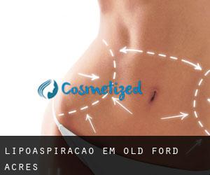 Lipoaspiração em Old Ford Acres