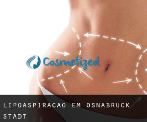 Lipoaspiração em Osnabrück Stadt Lipoaspiração em Osnabrück Stadt