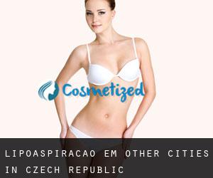 Lipoaspiração em Other Cities in Czech Republic